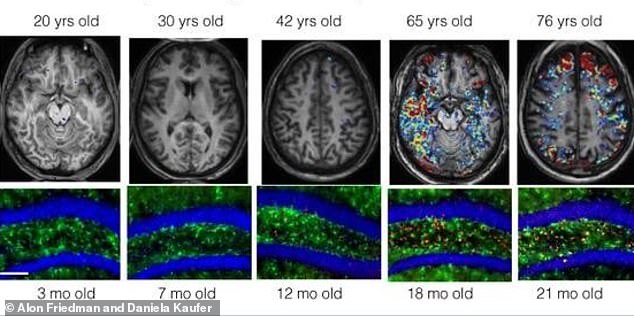 The barrier protection the brains of both humans (top) and mice (bottom) become more permeable with age (left to right) allowing harmful molecules ((colors, in human brains) from the blood to seep in - a pattern scientist now think may trigger inflammation and dementia