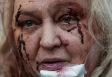 At least 18 people killed, dozens wounded in Russian attacks on Ukraine