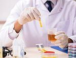 Home urine test could ‘revolutionise’ prostate cancer diagnosis