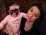 Mother cuddles up to her baby daughter with ‘Batman mask’ birth markÂ