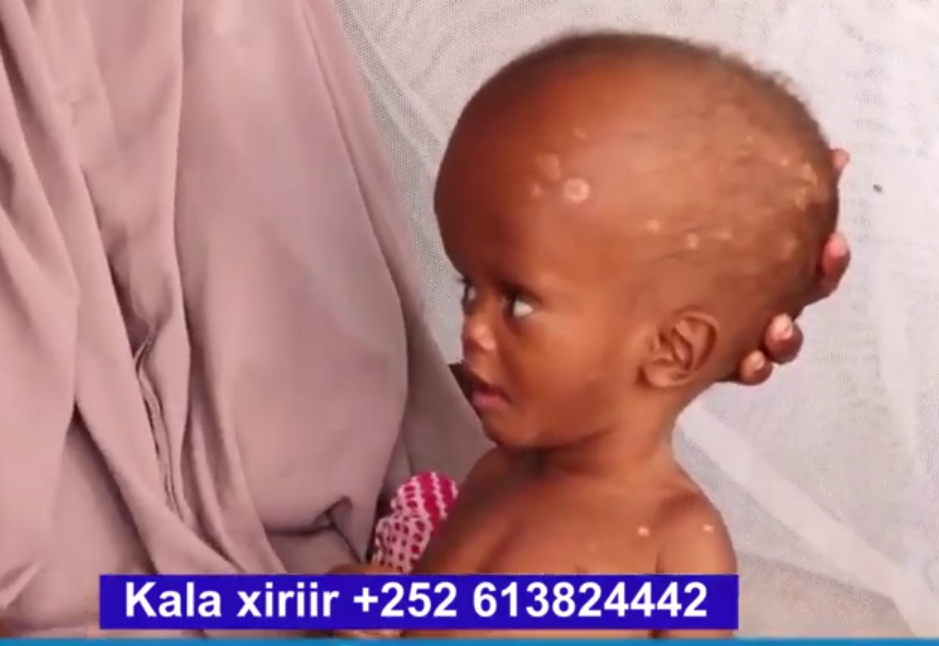 Hooyo Maryan “Wiilkeyga lacagta qaliinkiisa waa 1500 dollar mana awoodo Walaalayaal I Caawiya”+VIDEO